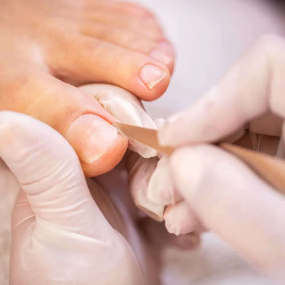 pedicura-cuticulas